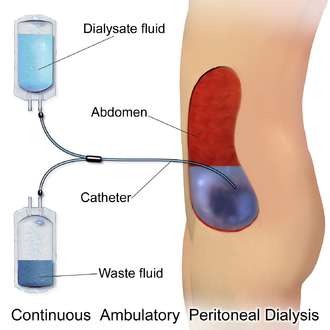 Peritoneal Dialysis Course