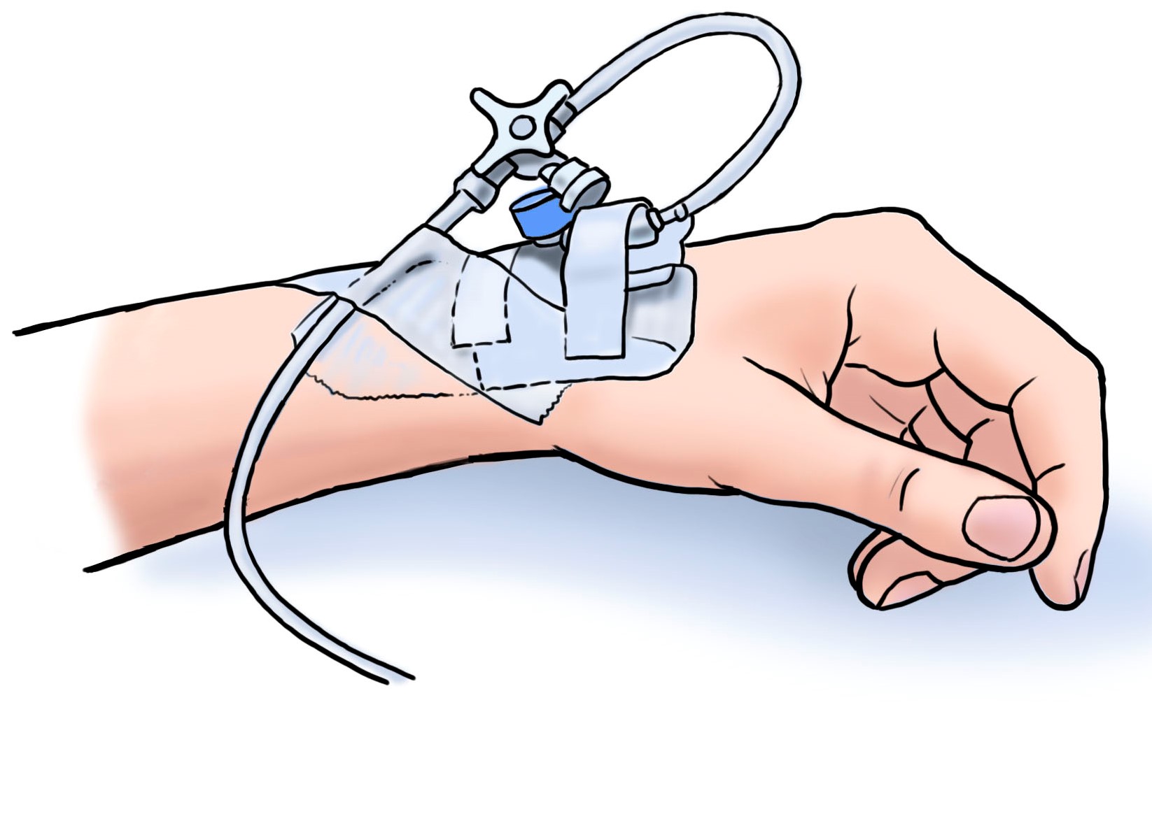 IV Therapy Care & Cannulation Course Theory Part